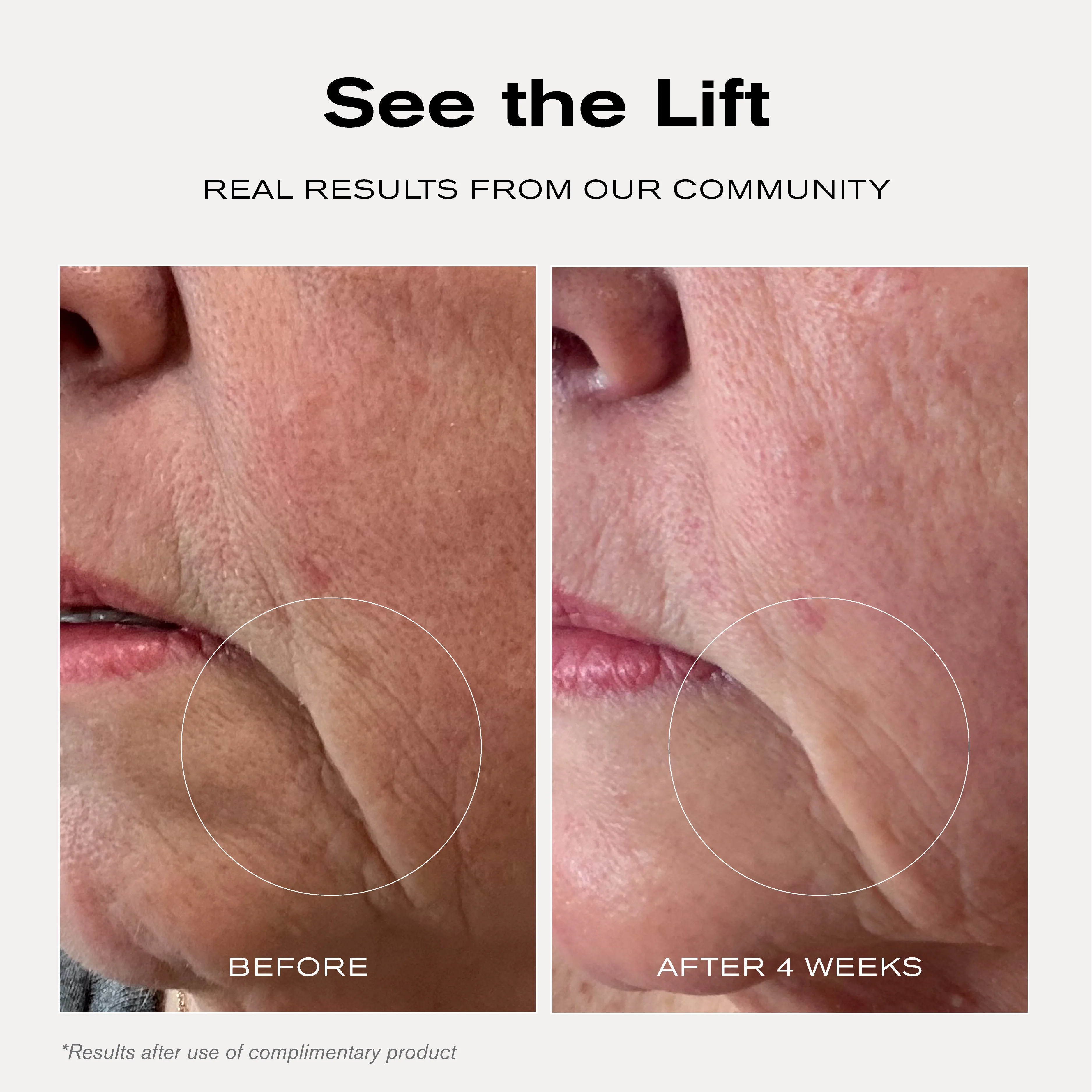 28-Day Tightening Treatment Mask Set - Image 5